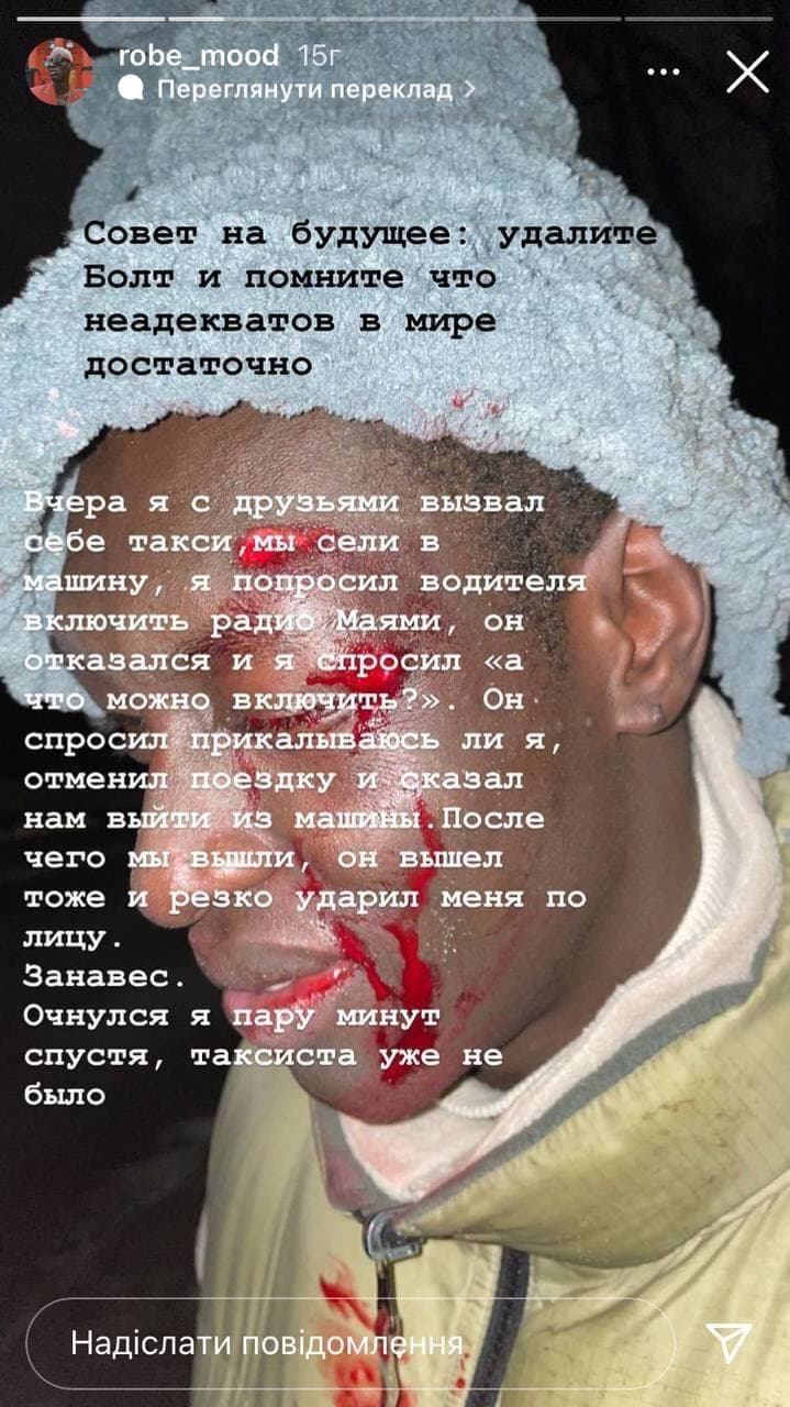 У Києві таксист побив до крові темношкірого пасажира: деталі кричущого випадку